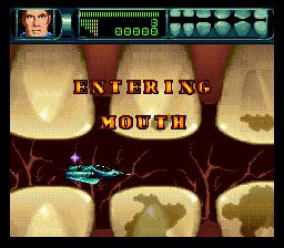 联合缩小军／人体旅程SFC游戏截图第5张