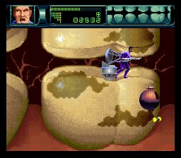 联合缩小军／人体旅程SFC游戏截图第7张