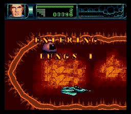 联合缩小军／人体旅程SFC游戏截图第13张