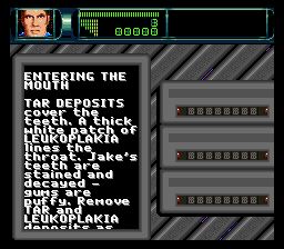 联合缩小军／人体旅程SFC游戏截图第4张