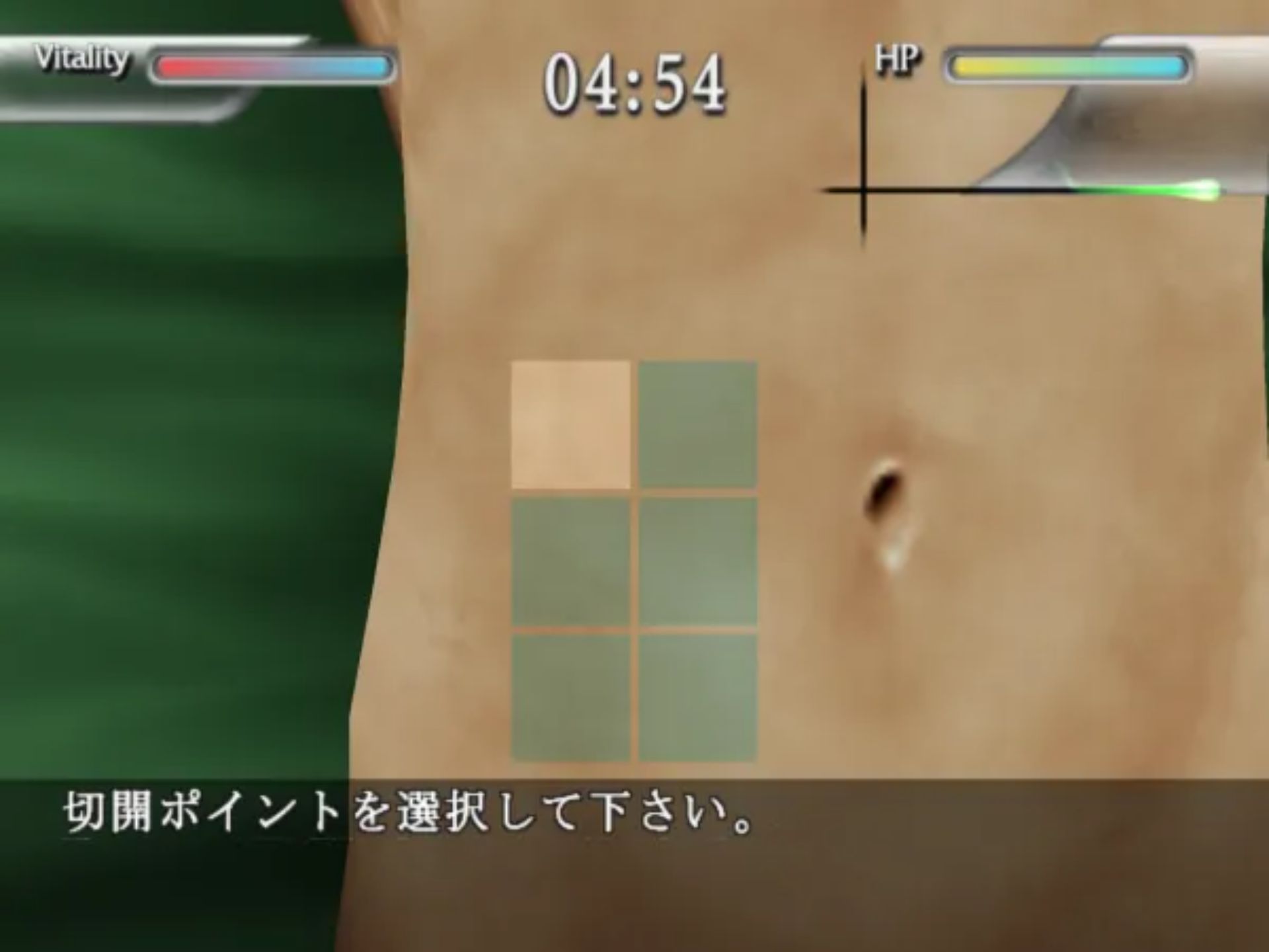 简单2000系列Vol.58：外科医生PS2游戏截图第14张