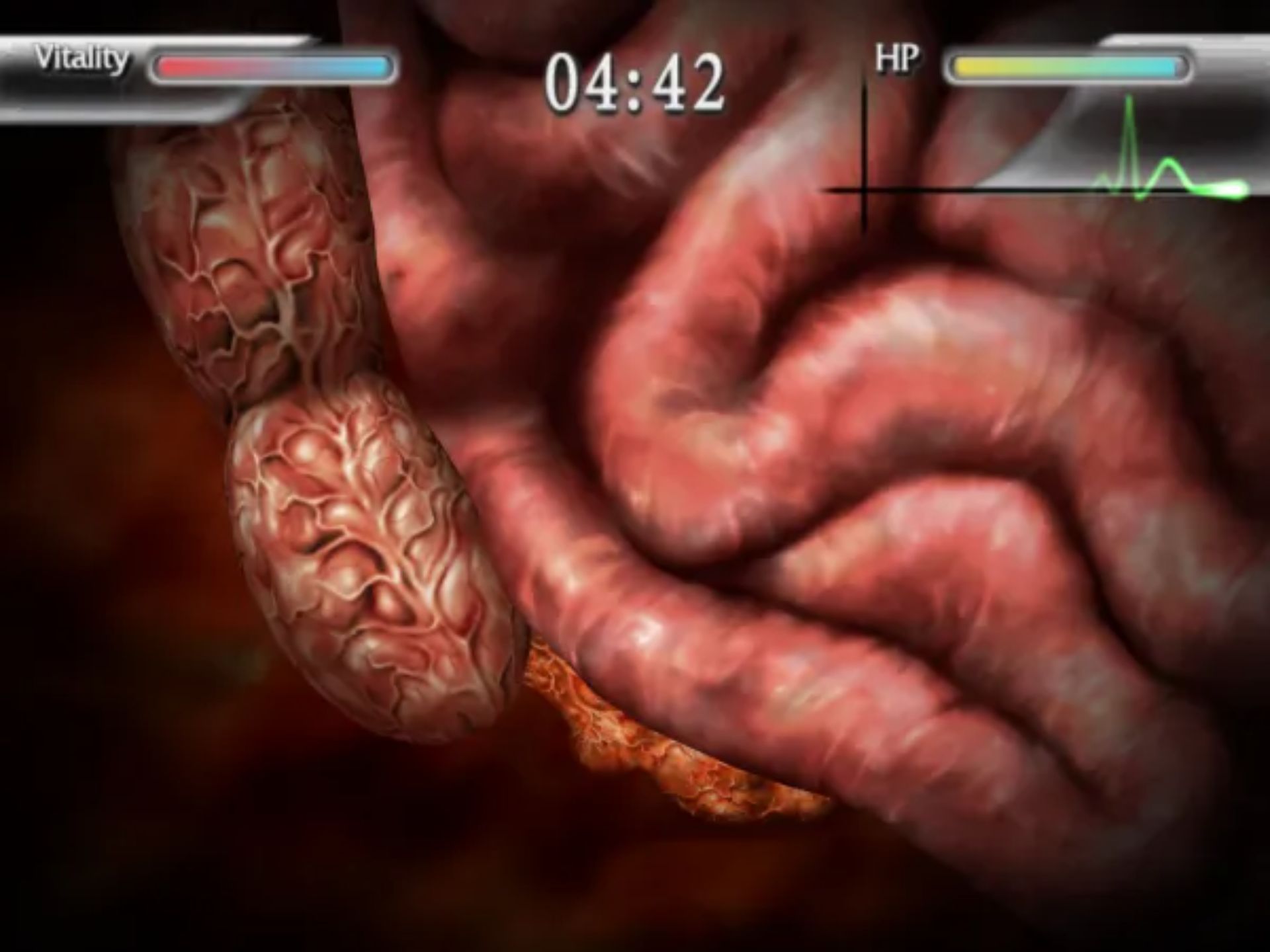 简单2000系列Vol.58：外科医生PS2游戏截图第15张