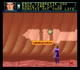 联合缩小军／人体旅程SFC游戏截图第9张